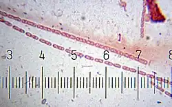 "Streptobacillus" Numbered ticks are 11 µm apart