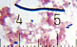 "Lactobacillus Bulgaricus" from a sample of yogurt. Numbered ticks are 11 μm apart.