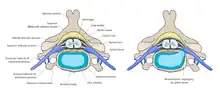 Normal situation and spinal disc herniation in cervical vertebrae