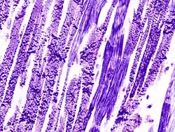 Contraction band necrosis. PTAH.