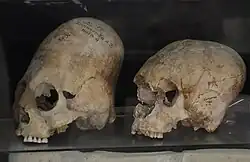 Elongated skulls from Afrasiab, Samarkand, Sogdia, 600–800&nbsp;CE