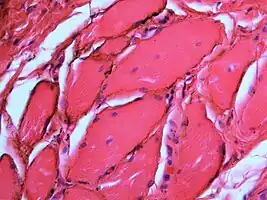 Silver sulfide deposits in the surrounding area of skeletal muscle fibers of the oral mucosa