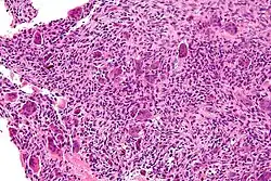 High magnification micrograph of an ABC