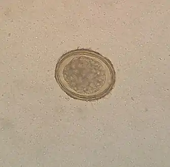 Fertile egg as can be seen in a microscope