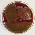 Bacillus cereus: "ground-glass" colonies displaying beta-hemolysis on blood agar: 188
