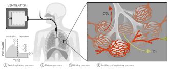 At physiological level, ventilators renew the air and its critical O2/CO2 exchange to pulmonary alveolus.