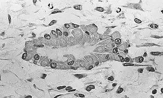 Light micrograph of undecalcified tissue displaying osteoblasts actively synthesizing osteoid (center)