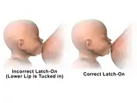Breastfeeding – Incorrect vs correct latch-on.