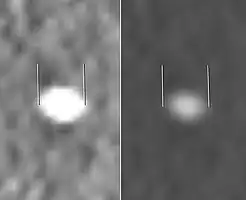Measurement of a 5.6&nbsp;mm large kidney stone in soft tissue versus skeletal CT window.