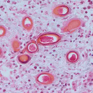Capillaria hepatica tissue