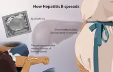 Depiction of how Hepatitis B spreads