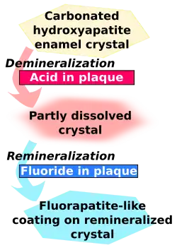 Carbonated hydroxyapatite enamel crystal is demineralised by acid in plaque and becomes partly dissolved crystal. This in turn is remineralised by fluoride in plaque to become a fluorapatite-like coating on remineralised crystal.