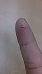 An incision: a small cut in a finger