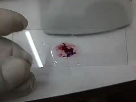 Gram stained smear of sputum for observation