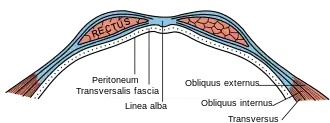Diagram of sheath of rectus.