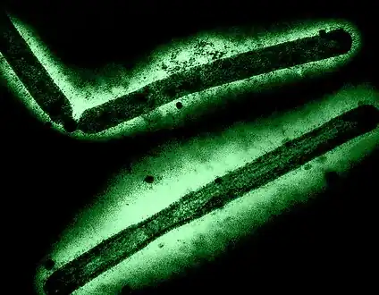 Influenza A virus particles -layout incorporates two CDC transmission electron micrographs [118]