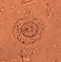 An egg of dwarf tapeworm