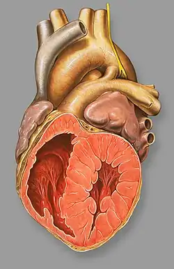 Patent ductus arteriosus