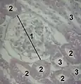 1 Glomerulus, 2 proximal tubule, 3 distal tubule