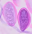 Later E. vermicularis eggs, of the same size as early eggs but having undergone more mitoses. H&E stain