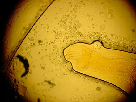 Ancyclostoma duodenale