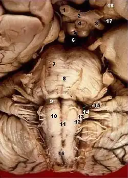 The hypoglossal nerve emerges as several rootlets (labelled here as number 12) from the olives of the medulla (labelled 13), part of the brainstem.