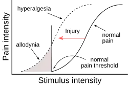 AMPS, pain amplification syndrome, juvenile fibromyalgia, childhood fibromyalgia