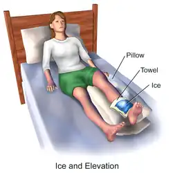 Ice & elevate a leg