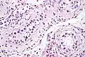 ITGCN. H&E stain.