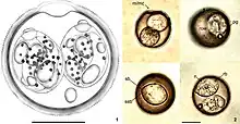 Figures 1–2; Sporulated oocysts of Isospora machadoae sp. nov. recovered from Turdus albicolis from Brazil: (1) line drawing; (2) photomicrographs. Note the micropyle and micropyle cap (m/mc), nucleus (n), polar granule (pg), refractile body (rb), rough oocyst wall (row), Stieda (sb) and sub-Stieda bodies (ssb) and the sporocyst residuum (sr). Scale bar = 10 μm.