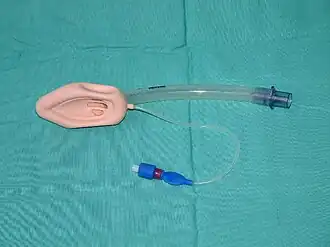 A laryngeal mask.