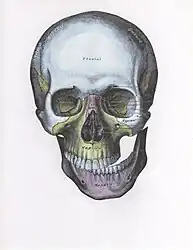 Front view of the skull with lateral dislocation of jaw.