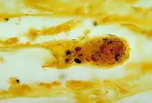 Kidney tissue showing leptospira bacteria