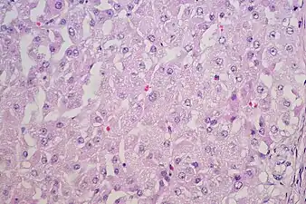 Lutel cells with round uniform nuclei with visible nucleoli