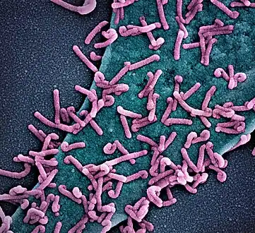 Scanning electron micrograph of Marburg virus particles (pink) both budding and attached to the surface of an infected VERO E6 cell[42]