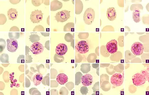 Microphotographs of Plasmodium ovale in Giemsa-stained thin blood films. a–c ring stages, d, e young trophozoites, f trophozoite, g late trophozoite, h young schizont, i–k growing schizont, l late schizont, m ruptured schizont, n young gametocyte, o, p developing macrogametocytes, q macrogametocyte, r microgametocyte.[6]