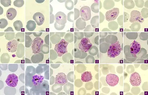 Microphotographs of Plasmodium vivax in Giemsa-stained thin blood films. a, b ring stages, c–e young trophozoites, f–h amoeboid trophozoites, i young schizont, j–l growing schizonts, m developed schizont, n mature schizont, o young gametocyte, p macroga‑metocyte, r, q microgametocytes.[18]