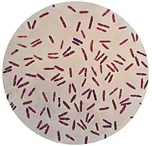 Microscope view of Moraxella lacunata bacteria