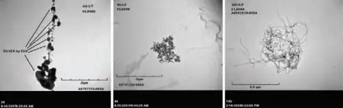 Three greyscale microscope images arranged horizontally.  The left two show agglomerations of black spots on a grey background, while the right one shows a mass of tangled fibers.