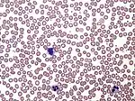 Normal human blood film