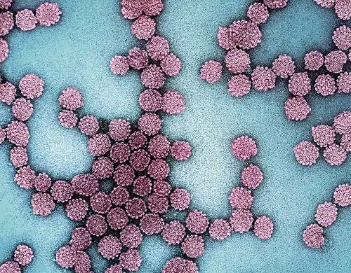 Electron micrograph of HPV virus particles harvested from cell culture supernatant