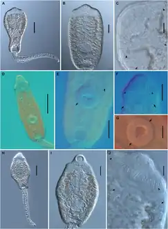 Cercariae of various echinostome species