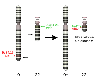 T(9,22) translocation