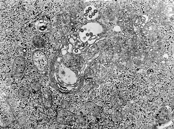 TEM micrograph of tissue infected with Rift Valley fever virus