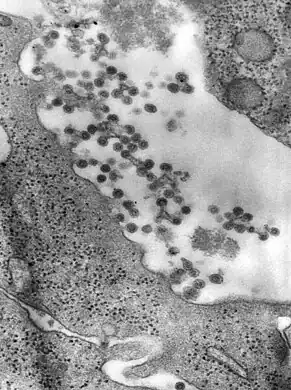 Negatively-stained transmission electron micrograph reveals the presence of Rubella virus virions