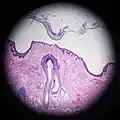 Scalp cross section showing hair follicle with sebaceous glands