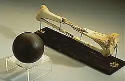 Broken leg bone and cannonball