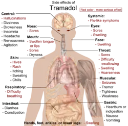 Main side effects of tramadol: Red color denotes more serious effects, requiring immediate contact with health provider.[2]