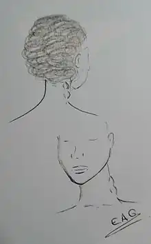 A sketch of two women suffering with lumps on the sides of their necks