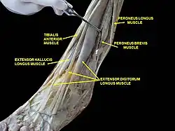 Muscles of leg, lateral view, deep dissection.